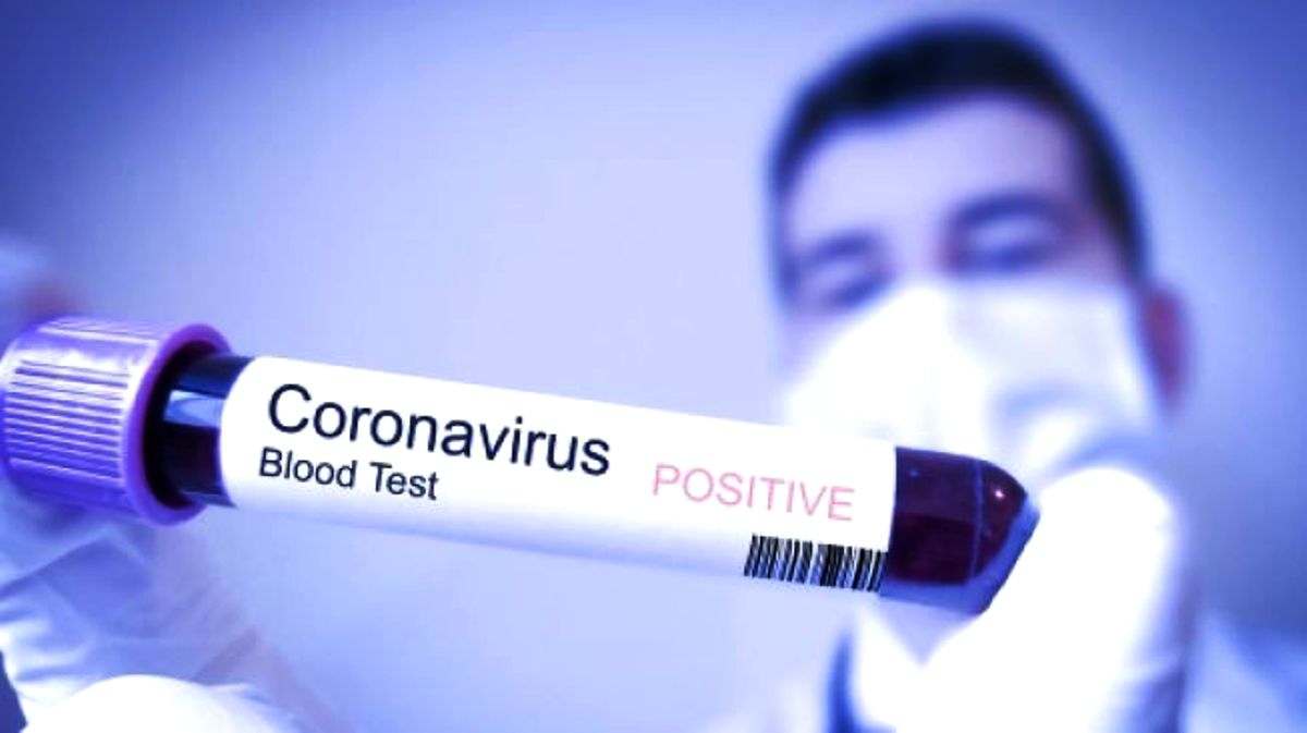 Virus Corona Vs Virus Kapitalis